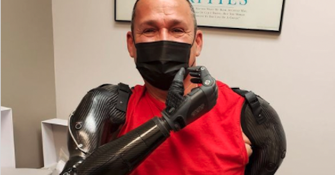 Luis stuurt zijn armprotheses aan met zijn brein afbeelding nieuwsbericht Luis stuurt zijn armprotheses aan met zijn brein afbeelding nieuwsbericht