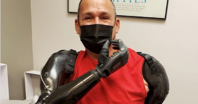 Luis stuurt zijn armprotheses aan met zijn brein afbeelding nieuwsbericht