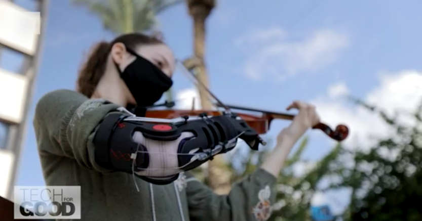 Yael speelt viool met goedkope armprothese afbeelding nieuwsbericht Yael speelt viool met goedkope armprothese afbeelding nieuwsbericht