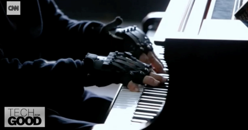 Pianist kan weer spelen dankzij handschoenen afbeelding nieuwsbericht