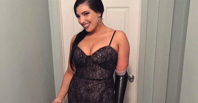 Dayna: ‘Ik voel me sexy dankzij mijn prothese-arm’ afbeelding nieuwsbericht