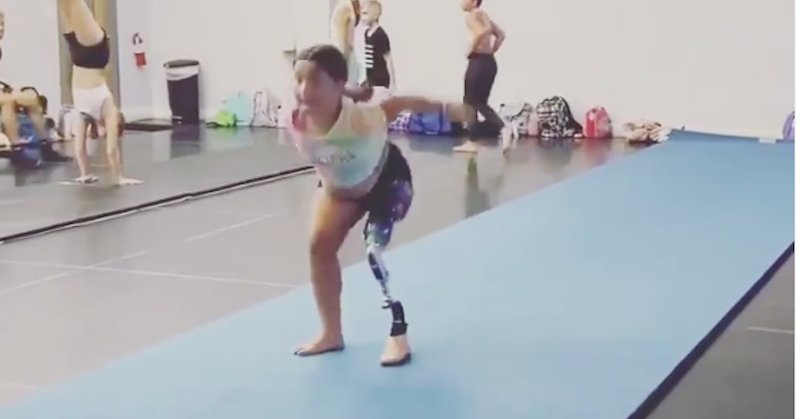 Kijk hoe Tessa een flikflak maakt met prothese! afbeelding nieuwsbericht Kijk hoe Tessa een flikflak maakt met prothese! afbeelding nieuwsbericht