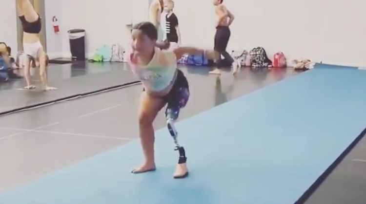 Kijk hoe Tessa een flikflak maakt met prothese! afbeelding nieuwsbericht