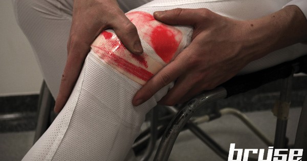 Dit slimme pak verkleurt als je een blessure oploopt (en dat niet kunt voelen) afbeelding nieuwsbericht