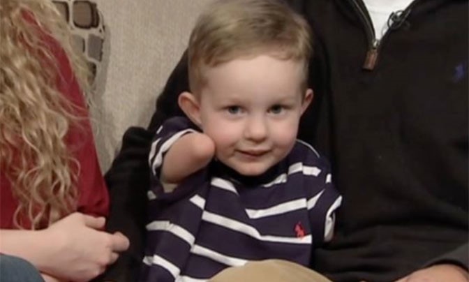 Jongetje (4) zonder armen en benen loopt voor het eerst afbeelding nieuwsbericht Jongetje (4) zonder armen en benen loopt voor het eerst afbeelding nieuwsbericht