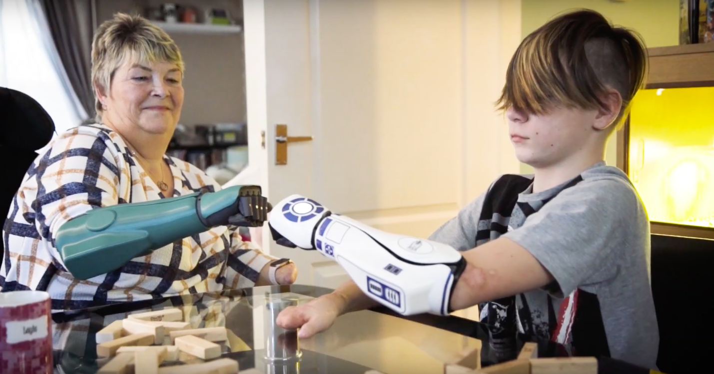 Kye is een superheld met zijn Star Wars arm afbeelding nieuwsbericht Kye is een superheld met zijn Star Wars arm afbeelding nieuwsbericht