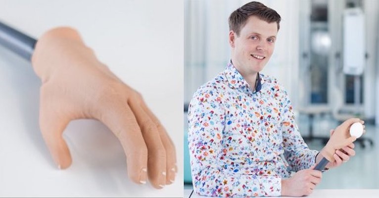 Deze handprothese kan dingen vastpakken afbeelding nieuwsbericht Deze handprothese kan dingen vastpakken afbeelding nieuwsbericht